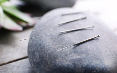 Acupuntura Indolora: Qué es Toyohari y para Quién Está Indicada