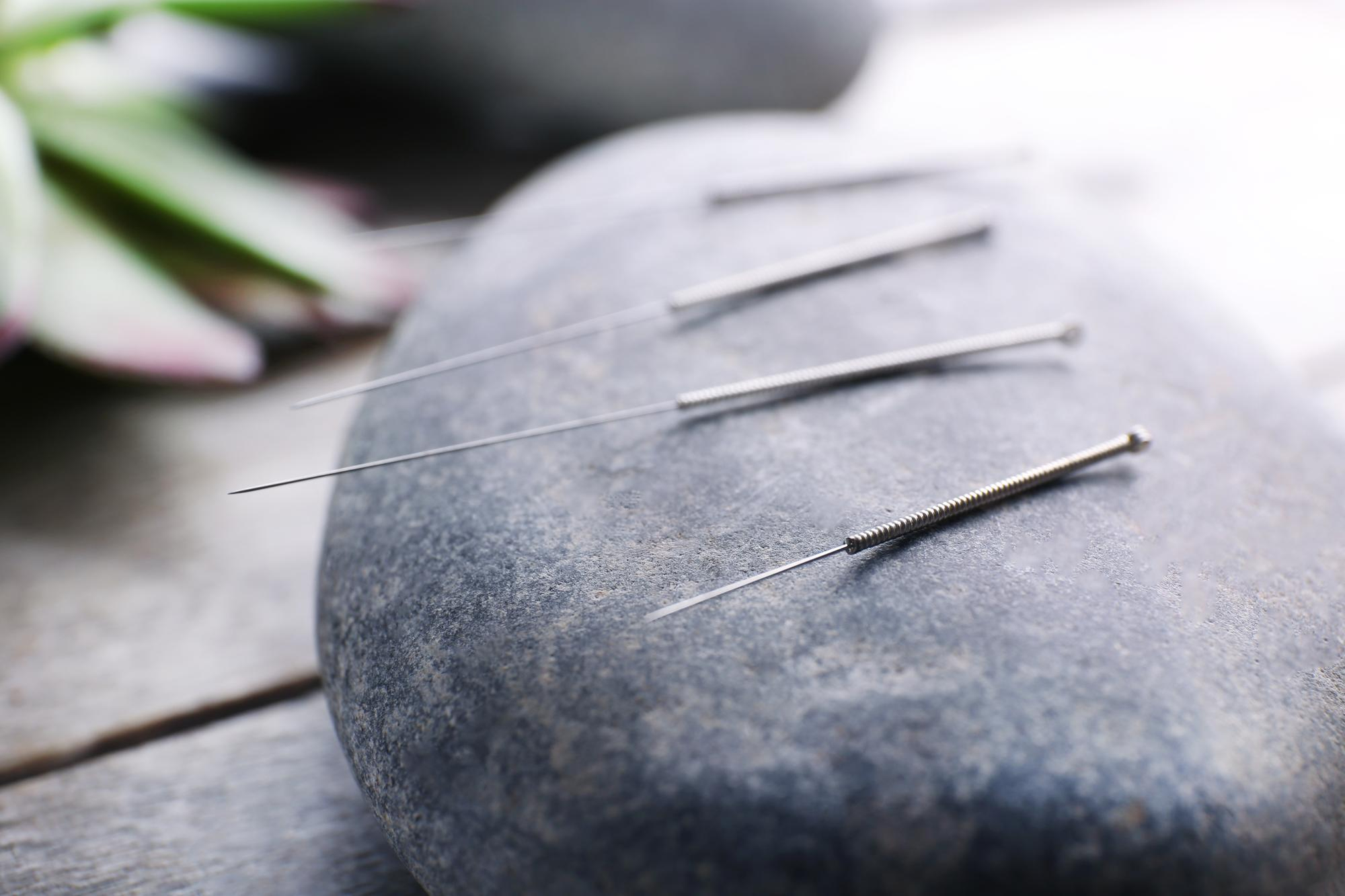Acupuntura indolora – que es Toyohari- blog Acupuntura indolora - que es Toyohari- blog