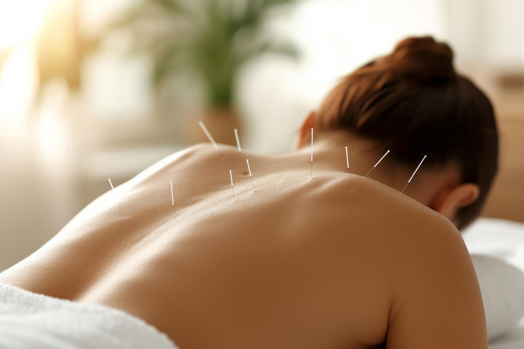 Beneficios de la Acupuntura para la Ansiedad_Banner Beneficios de la Acupuntura para la Ansiedad_Banner
